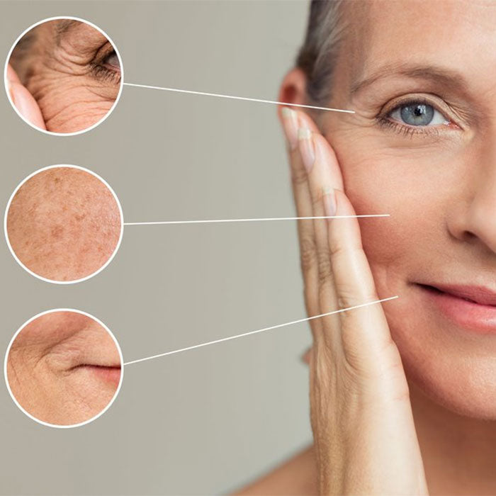 limina las arrugas y las marcas de la piel con Dermaccina CoQ-10