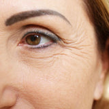 Dermaccina CoQ-10 Crema