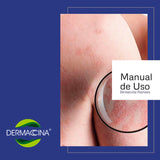 Dermaccina Psoriasis Células Madres Tratamiento Especial