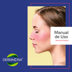 Dermaccina Rosacea Stem Cells Basic Treatment