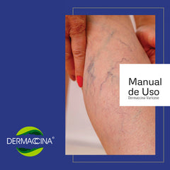 Dermaccina Varicose Veins Advanced Treatment