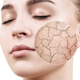 Dermaccina Moisturizing Cream hidrata tu piel