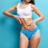 Dile adiós a las manchas del vitiligo con Dermaccina Vitiligo